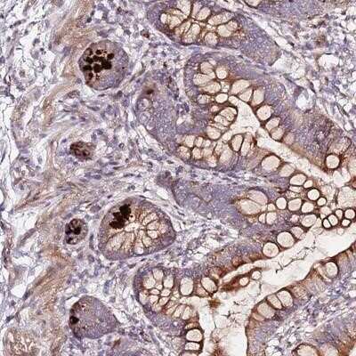 Immunohistochemistry-Paraffin: HSD17B7 Antibody [NBP2-14102] - Staining of human small intestine shows strong cytoplasmic positivity in glandular cells.