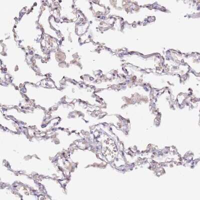 Immunohistochemistry-Paraffin: HSD17B7 Antibody [NBP2-14102] - Staining of human lung shows moderate cytoplasmic positivity in pneumocytes and macrophages.