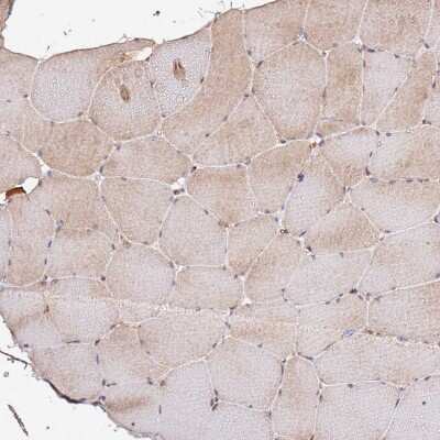 Immunohistochemistry-Paraffin: HSD17B7 Antibody [NBP2-14102] - Staining of human skeletal muscle shows cytoplasmic positivity in myocytes.