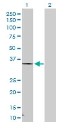 Western Blot: HSD17B7 Antibody [H00051478-D01P] - Analysis of HSD17B7 expression in transfected 293T cell line by HSD17B7 polyclonal antibody.Lane 1: HSD17B7 transfected lysate(38.20 KDa).Lane 2: Non-transfected lysate.