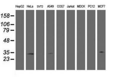 Western Blot: HSD17B8 Antibody (OTI2E12) - Azide and BSA Free [NBP2-71350] - Analysis of extracts (35ug) from 9 different cell lines. (HepG2: human; HeLa: human; SVT2: mouse; A549: human; COS7: monkey; Jurkat: human; MDCK: canine; PC12: rat; MCF7: human).