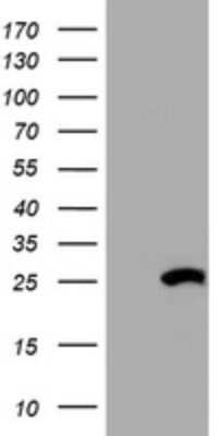Western Blot: HSD17B8 Antibody (OTI2E12) - Azide and BSA Free [NBP2-71350] - Analysis of HEK293T cells were transiently transfected with the pCMV6-ENTRY control (Left lane) or pCMV6-ENTRY HSD17B8.