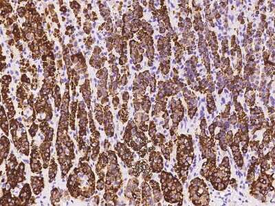 Immunohistochemistry-Paraffin: HSD3B1 Antibody [NBP2-99334] - Immunochemical staining of human HSD3B1 in human adrenal gland with rabbit polyclonal antibody at 1:300 dilution, formalin-fixed paraffin embedded sections.
