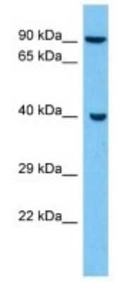 Western Blot: HSD3B1 Antibody [NBP3-10203] - Western blot analysis of HSD3B1 in Mouse Brain lysates. Antibody dilution at 1ug/ml