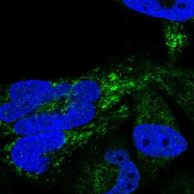 Immunocytochemistry/Immunofluorescence: HSDL2 Antibody [NBP2-14104] - Staining of human cell line RH-30 shows localization to mitochondria. Antibody staining is shown in green.