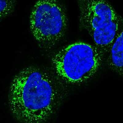 Immunocytochemistry/ Immunofluorescence HSDL2 Antibody