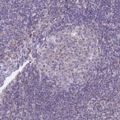 Immunohistochemistry-Paraffin: HSDL2 Antibody [NBP2-14104] - Staining of human lymph node shows low expression as expected.