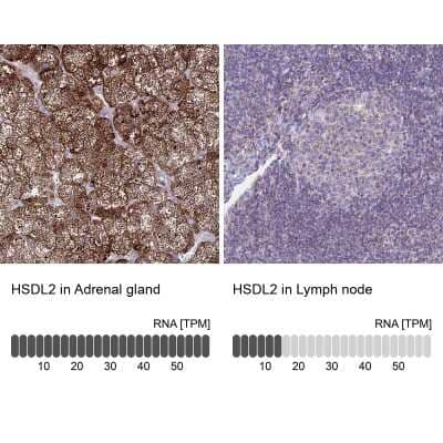 Immunohistochemistry-Paraffin: HSDL2 Antibody [NBP2-14104] - Staining in human adrenal gland and lymph node tissues using anti-HSDL2 antibody. Corresponding HSDL2 RNA-seq data are presented for the same tissues.