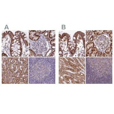 <b>Independent Antibodies Validation and Orthogonal Strategies Validation.</b>Immunohistochemistry-Paraffin: HSDL2 Antibody [NBP2-14104] - Staining of human colon, kidney, liver and lymph node using Anti-HSDL2 antibody NBP2-14104 (A) shows similar protein distribution across tissues to independent antibody NBP2-14105 (B).