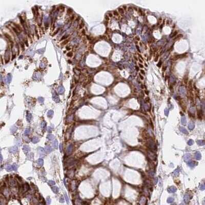 Immunohistochemistry-Paraffin: HSDL2 Antibody [NBP2-14104] - Staining of human colon.