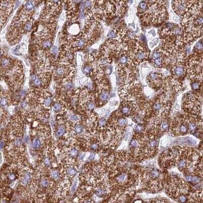 Immunohistochemistry-Paraffin: HSDL2 Antibody [NBP2-14104] - Staining of human liver.