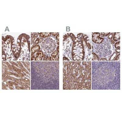 Immunohistochemistry-Paraffin HSDL2 Antibody