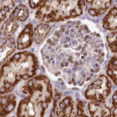 Immunohistochemistry-Paraffin HSDL2 Antibody