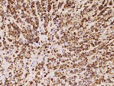 Immunohistochemistry-Paraffin: HSDL2 Antibody [NBP2-97749] - Immunochemical staining of human HSDL2 in human liver with rabbit polyclonal antibody at 1:300 dilution, formalin-fixed paraffin embedded sections.