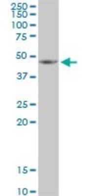 Western Blot: HSDL2 Antibody [H00084263-B01P] - Analysis of HSDL2 expression in HeLa.