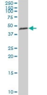 Western Blot: HSDL2 Antibody [H00084263-B01P] - Analysis of HSDL2 expression in human liver.