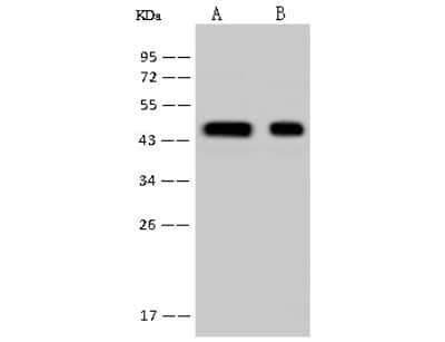 Western Blot: HSDL2 Antibody [NBP2-97749] - Anti-HSDL2 rabbit polyclonal antibody at 1:500 dilution. Lane A: Hela Whole Cell Lysate Lane B: 293 Whole Cell Lysate Lysates/proteins at 30 ug per lane. Secondary Goat Anti-Rabbit IgG (H+L)/HRP at 1/10000 dilution. Developed using the ECL technique. Performed under reducing conditions. Predicted band size: 45 kDa. Observed band size: 45 kDa