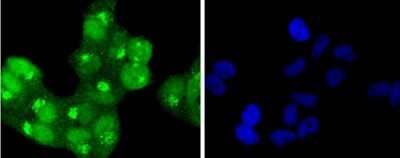 Immunocytochemistry/Immunofluorescence: HSF1 [p Ser326] Antibody (SU31-03) [NBP2-67455] - Staining p-HSF1(S326) in Hela cells (green). The nuclear counter stain is DAPI (blue). Cells were fixed in paraformaldehyde, permeabilised with 0.25% Triton X100/PBS.