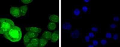 Immunocytochemistry/Immunofluorescence: HSF1 [p Ser326] Antibody (SU31-03) [NBP2-67455] - Staining p-HSF1(S326) in AGS cells (green). The nuclear counter stain is DAPI (blue). Cells were fixed in paraformaldehyde, permeabilised with 0.25% Triton X100/PBS.