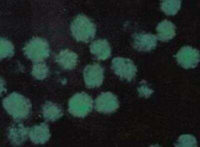 Immunocytochemistry/Immunofluorescence: HSF1 [p Ser326] Antibody (SU31-03) [NBP2-67455] - U937 human histiocytic lymphoma cell line stained with HSF1 [p Ser326] Antibody (SU31-03). ICC/IF image submitted by a verified customer review.