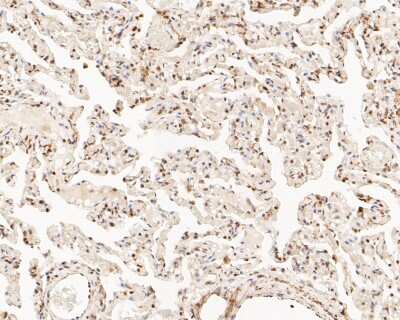 Immunohistochemistry-Paraffin: HSF1 [p Ser326] Antibody (SU31-03) [NBP2-67455] - Immunohistochemical analysis of paraffin-embedded human lung tissue using anti-HSF1 antibody. The section was pre-treated using heat mediated antigen retrieval with sodium citrate buffer (pH 6.0) for 20 minutes. The tissues were blocked in 5% BSA for 30 minutes at room temperature, washed with ddH2O and PBS, and then probed with the primary antibody (ET1608-11, 1/50) for 30 minutes at room temperature. The detection was performed using an HRP conjugated compact polymer system. DAB was used as the chromogen. Tissues were counterstained with hematoxylin and mounted with DPX.
