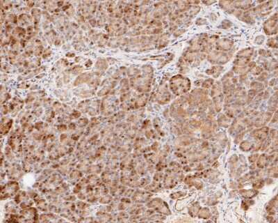 Immunohistochemistry-Paraffin: HSF1 [p Ser326] Antibody (SU31-03) [NBP2-67455] - Immunohistochemical analysis of paraffin-embedded human pancreas tissue using anti-HSF1 antibody. The section was pre-treated using heat mediated antigen retrieval with sodium citrate buffer (pH 6.0) for 20 minutes. The tissues were blocked in 5% BSA for 30 minutes at room temperature, washed with ddH2O and PBS, and then probed with the primary antibody (ET1608-11, 1/50) for 30 minutes at room temperature. The detection was performed using an HRP conjugated compact polymer system. DAB was used as the chromogen. Tissues were counterstained with hematoxylin and mounted with DPX.