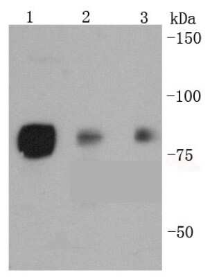 Western Blot: HSF1 [p Ser326] Antibody (SU31-03) [NBP2-67455] - Analysis of p-HSF1(S326) on different lysates using anti-p-HSF1(S326) antibody at 1/1,000 dilution. Positive control: Lane 1: Hela Lane 2: BT20 Lane 3: AGS