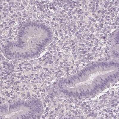 Immunohistochemistry-Paraffin: HSF5 Antibody [NBP2-49401] - Staining of human endometrium shows low expression as expected.