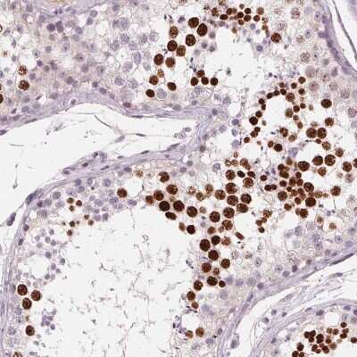 Immunohistochemistry-Paraffin: HSF5 Antibody [NBP2-49401] - Staining of human testis shows high expression.
