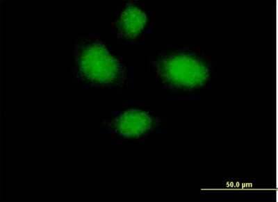 Immunocytochemistry/Immunofluorescence: HSH2D Antibody [H00084941-B01P] - Analysis of purified antibody to HSH2D on HeLa cell. (antibody concentration 10 ug/ml)