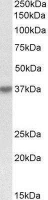 Western Blot: HSH2D Antibody [NBP1-52023] - (0.3ug/ml) staining of K562 lysate (35ug protein in RIPA buffer). Primary incubation was 1 hour. Detected by chemiluminescence.