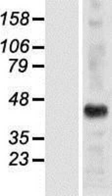 Western Blot: HSH2D Overexpression Lysate (Adult Normal) [NBP2-05959] Left-Empty vector transfected control cell lysate (HEK293 cell lysate); Right -Over-expression Lysate for HSH2D.