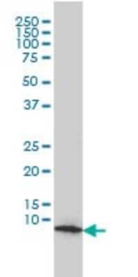 Western Blot: HSP10/EPF Antibody (4C11-B11) [H00003336-M01] - HSPE1 monoclonal antibody (M01), clone 4C11-B11 Analysis of HSPE1 expression in COLO 320 HSR.