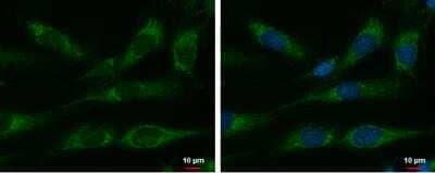 Immunocytochemistry/Immunofluorescence: HSP10/EPF Antibody [NBP2-16890] - SKNSH cells were fixed in 2% paraformaldehyde/culture medium at 37 degrees C  for 15 min. Green: HSP10 protein stained by HSP10 antibody diluted at 1:500.  Blue: Hoechst 33342 staining.