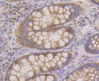 Immunohistochemistry-Paraffin: HSP10/EPF Antibody (JG82-34) [NBP2-75529] - Analysis of paraffin-embedded human colon tissue using anti-Cpn10 antibody. Counter stained with hematoxylin.
