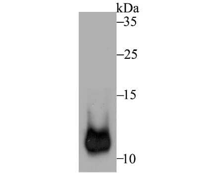 Western Blot: HSP10/EPF Antibody (JG82-34) [NBP2-75529] - Analysis of Cpn10 on mouse liver tissue lysate using anti-Cpn10 antibody at 1/1,000 dilution.