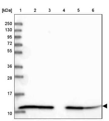 Western Blot: HSP10/EPF Antibody [NBP2-34055] - Lane 1: Marker  [kDa] 250, 130, 95, 72, 55, 36, 28, 17, 10.  Lane 2: Human cell line RT-4.  Lane 3: Human cell line U-251MG sp.  Lane 4: Human plasma (IgG/HSA depleted).  Lane 5: Human liver tissue.  Lane 6: Human tonsil tissue