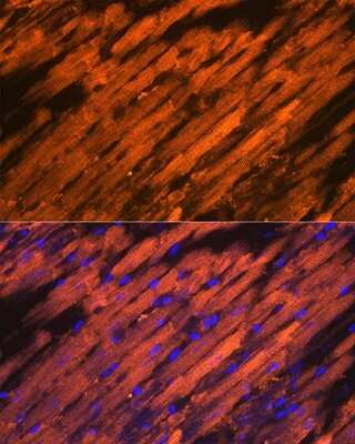 Immunohistochemistry: HSP20/HSPB6 Antibody (3J5N1) [NBP3-16751] - Immunofluorescence analysis of rat heart using HSP20/HSPB6 Rabbit mAb (NBP3-16751) at dilution of 1:100 (40x lens). Blue: DAPI for nuclear staining.