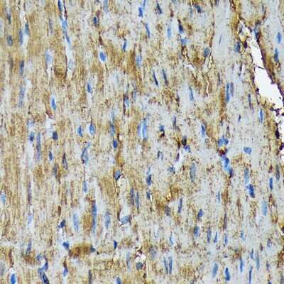 Immunohistochemistry-Paraffin: HSP20/HSPB6 Antibody (3J5N1) [NBP3-16751] - Immunohistochemistry of paraffin-embedded rat heart using HSP20/HSPB6 Rabbit mAb (NBP3-16751) at dilution of 1:100 (40x lens).Perform microwave antigen retrieval with 10 mM Tris/EDTA buffer pH 9.0 before commencing with IHC staining protocol.