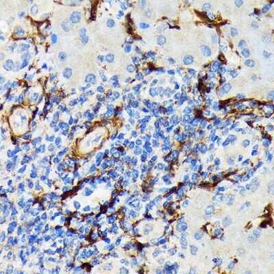 Immunohistochemistry-Paraffin: HSP20/HSPB6 Antibody (3J5N1) [NBP3-16751] - Immunohistochemistry of paraffin-embedded human liver using HSP20/HSPB6 Rabbit mAb (NBP3-16751) at dilution of 1:100 (40x lens).Perform microwave antigen retrieval with 10 mM Tris/EDTA buffer pH 9.0 before commencing with IHC staining protocol.