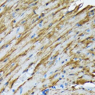 Immunohistochemistry-Paraffin: HSP20/HSPB6 Antibody (3J5N1) [NBP3-16751] - Immunohistochemistry of paraffin-embedded mouse heart using HSP20/HSPB6 Rabbit mAb (NBP3-16751) at dilution of 1:100 (40x lens).Perform microwave antigen retrieval with 10 mM Tris/EDTA buffer pH 9.0 before commencing with IHC staining protocol.