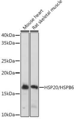 Western Blot: HSP20/HSPB6 Antibody (3J5N1) [NBP3-16751] - Western blot analysis of extracts of various cell lines, using HSP20/HSPB6 Rabbit mAb (NBP3-16751) at 1:1000 dilution. Secondary antibody: HRP Goat Anti-Rabbit IgG (H+L) at 1:10000 dilution. Lysates/proteins: 25ug per lane. Blocking buffer: 3% nonfat dry milk in TBST. Detection: ECL Basic Kit. Exposure time: 1s.