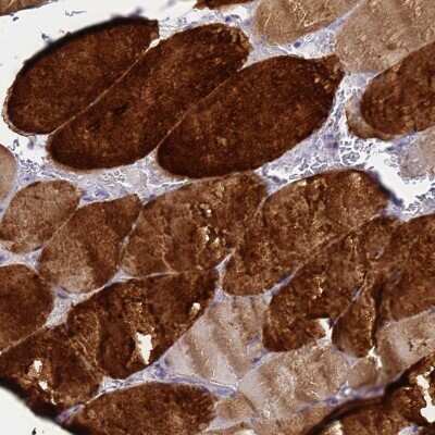 Immunohistochemistry-Paraffin: HSP20/HSPB6 Antibody [NBP2-32027] - Staining of human skeletal muscle shows high expression.