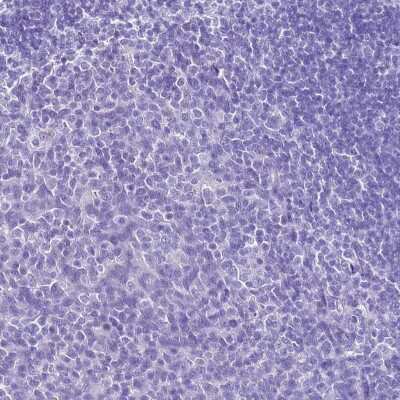 Immunohistochemistry-Paraffin: HSP20/HSPB6 Antibody [NBP2-32027] - Staining of human tonsil shows low expression as expected.