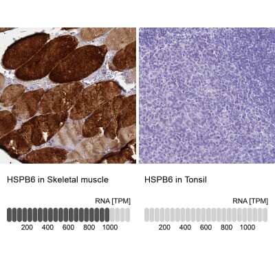 <b>Orthogonal Strategies Validation. </b>Immunohistochemistry-Paraffin: HSP20/HSPB6 Antibody [NBP2-32027] - Staining in human skeletal muscle and tonsil tissues using anti-HSPB6 antibody. Corresponding HSPB6 RNA-seq data are presented for the same tissues.