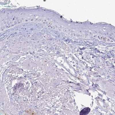 Immunohistochemistry-Paraffin: HSP20/HSPB6 Antibody [NBP2-38739] - Staining of human skin shows low expression as expected.