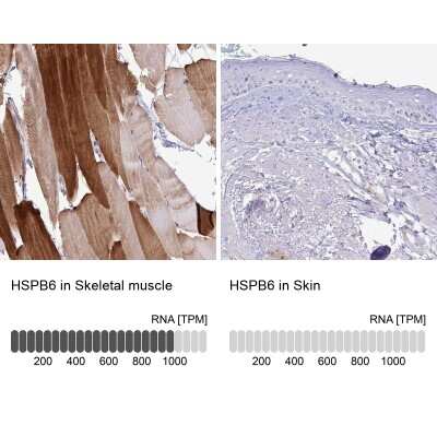 <b>Orthogonal Strategies Validation. </b>Immunohistochemistry-Paraffin: HSP20/HSPB6 Antibody [NBP2-38739] - Staining in human skeletal muscle and skin tissues using anti-HSPB6 antibody. Corresponding HSPB6 RNA-seq data are presented for the same tissues.