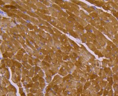 Immunohistochemistry-Paraffin: HSP20/HSPB6 Antibody (SD086-03) [NBP2-67815] - Analysis of paraffin-embedded mouse heart tissue using anti-Hsp20 antibody. Counter stained with hematoxylin.