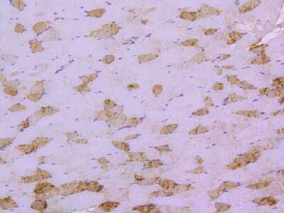 Immunohistochemistry-Paraffin: HSP20/HSPB6 Antibody (SD086-03) [NBP2-67815] - Analysis of paraffin-embedded mouse skeletal muscle tissue using anti-Hsp20 antibody. Counter stained with hematoxylin.