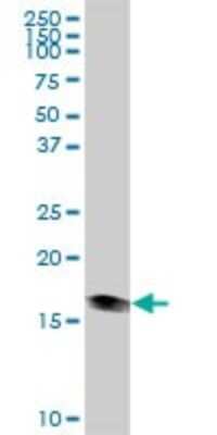 Western Blot: HSP20/HSPB6 Antibody [H00126393-B01P] - Analysis of HSPB6 expression in human liver.